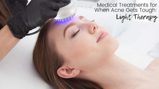 Medical Treatments for When Acne Gets Tough – Part 2
